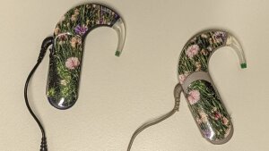 Cochlear Implants