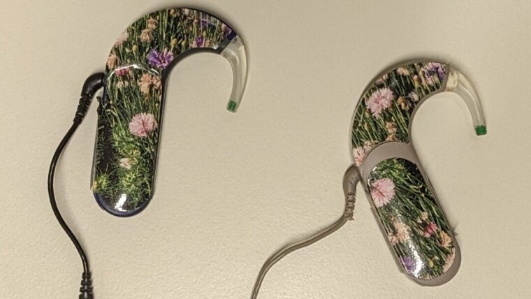 Cochlear Implants